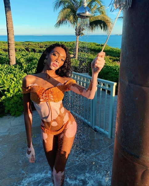 winnie harlow улетела в отпуск на багамы! как всегда сексуальна.